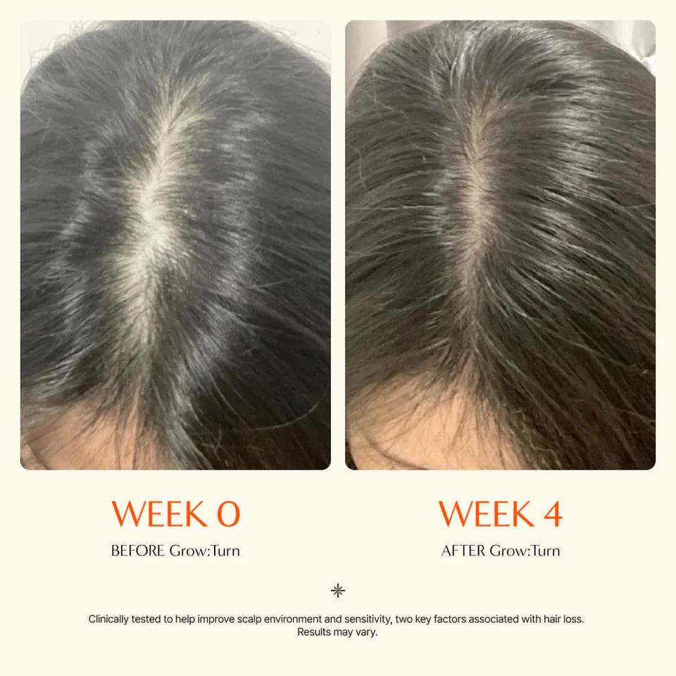 GROWTURN Korean Hair Growth Serum