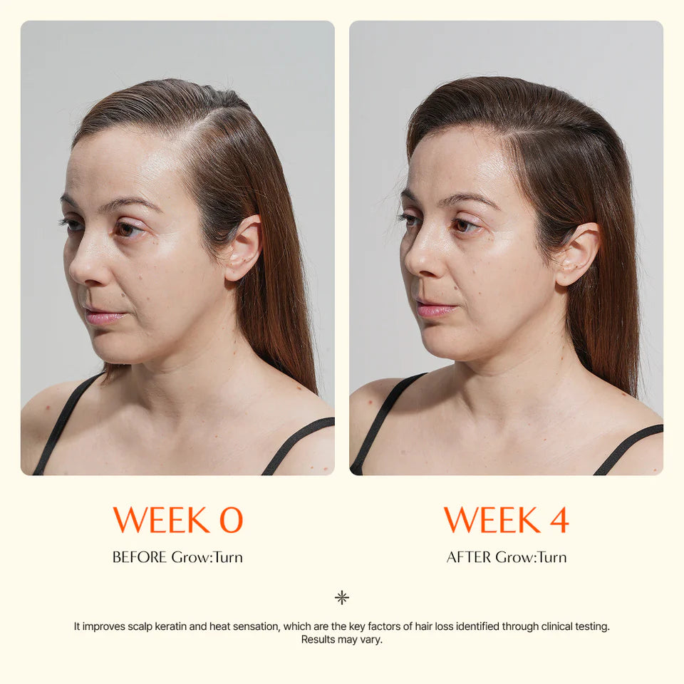 GROWTURN Korean Hair Growth Serum