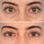 Peptide-Powered Deep Collagen Eye Mask