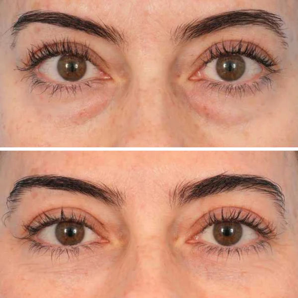Peptide-Powered Deep Collagen Eye Mask