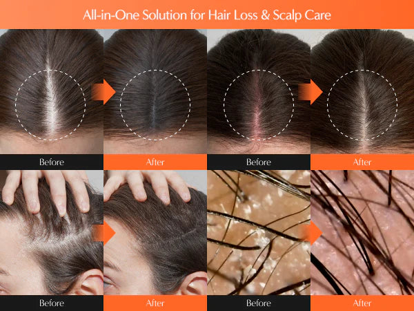 GROWTURN Korean Hair Growth Serum