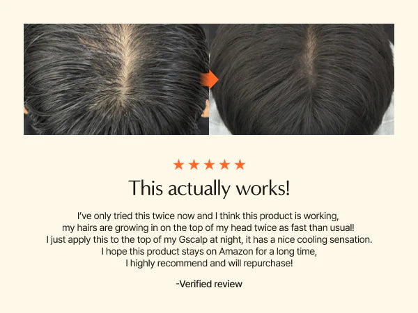 GROWTURN Korean Hair Growth Serum