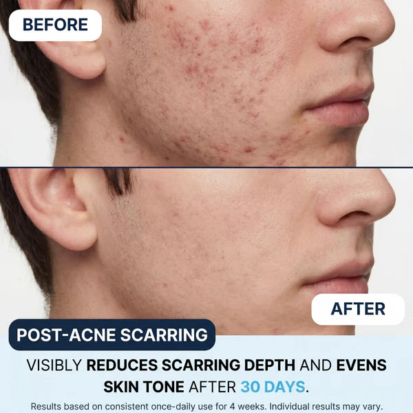 GHK -COPPER PEPTIDE SERUM